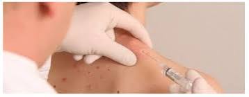 Terapia del Dolor Riobamba. Tratamiento del dolor cr�nico, Tratamiento de migra�a y dolores de cabeza, Tratamiento del estr�s.